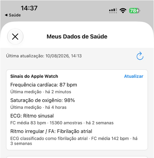 Sinais do Apple Watch no app HUG Saúde